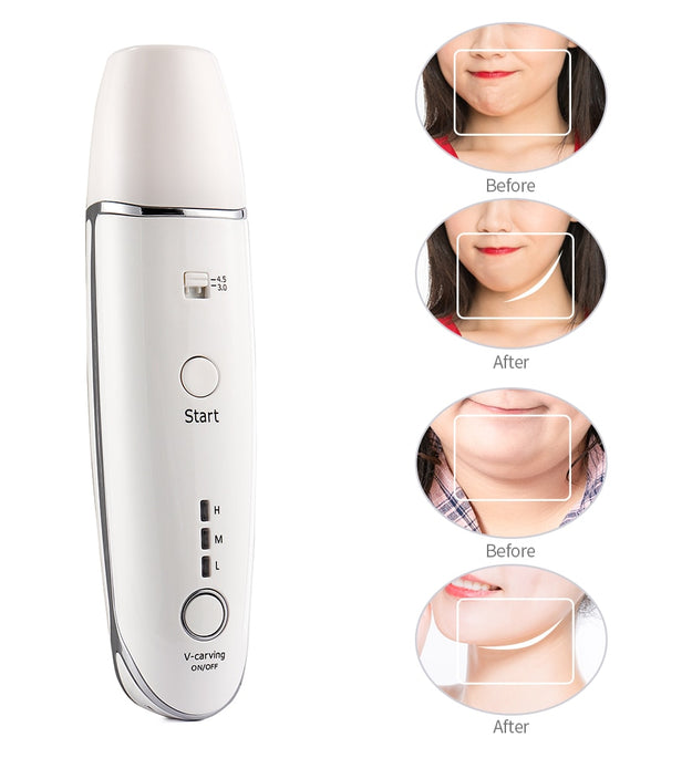 Wrinkle Removal V-Shape Anti-Aging Skin Care Beauty Device